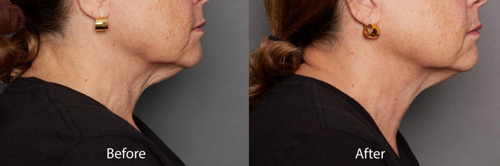 13 best neck firming creams that actually tighten skin, according to lab testing