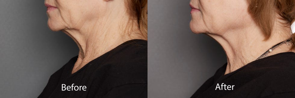 13 best neck firming creams that actually tighten skin, according to lab testing