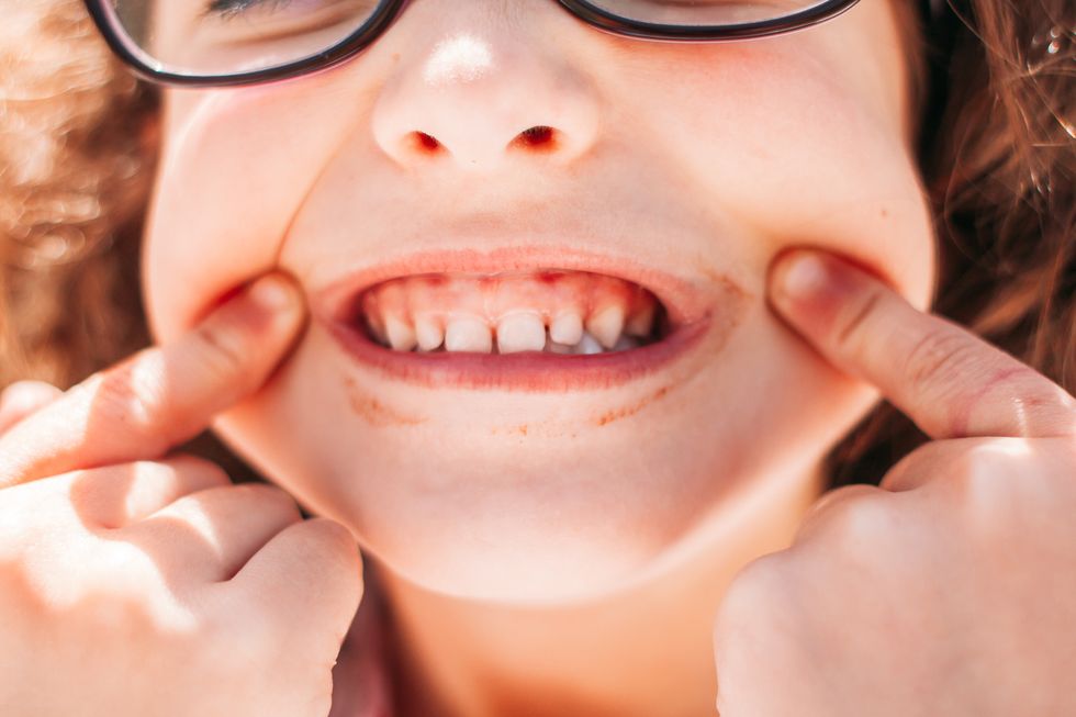 niña forzando una sonrisa para mostrar sus dientes