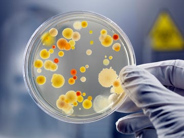 a petri dish with bacteria