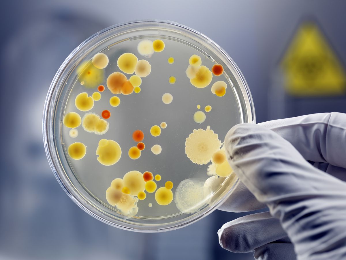 a petri dish with bacteria