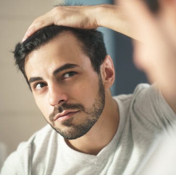 thinning hair men