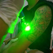 green laser shining on tattooed arm