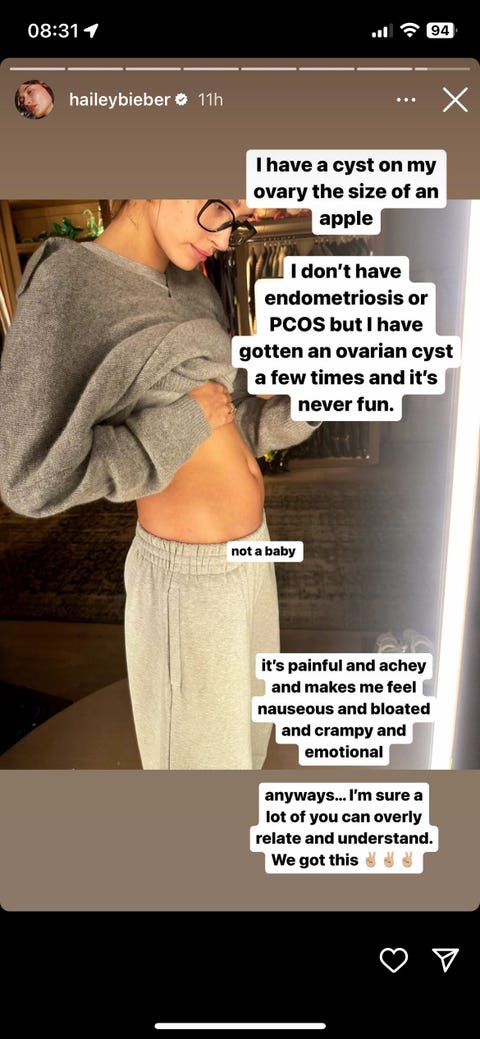 hailey bieber showing her ovarian cyst