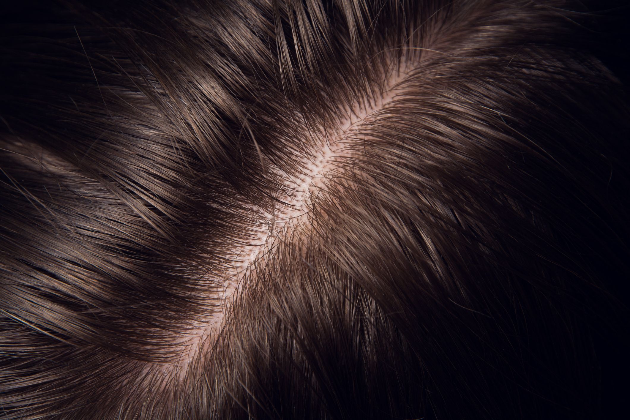 Red Spots on Scalp: Causes, Treatment, and More