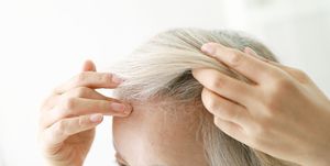 hair loss thinning hair mistakes to avoid