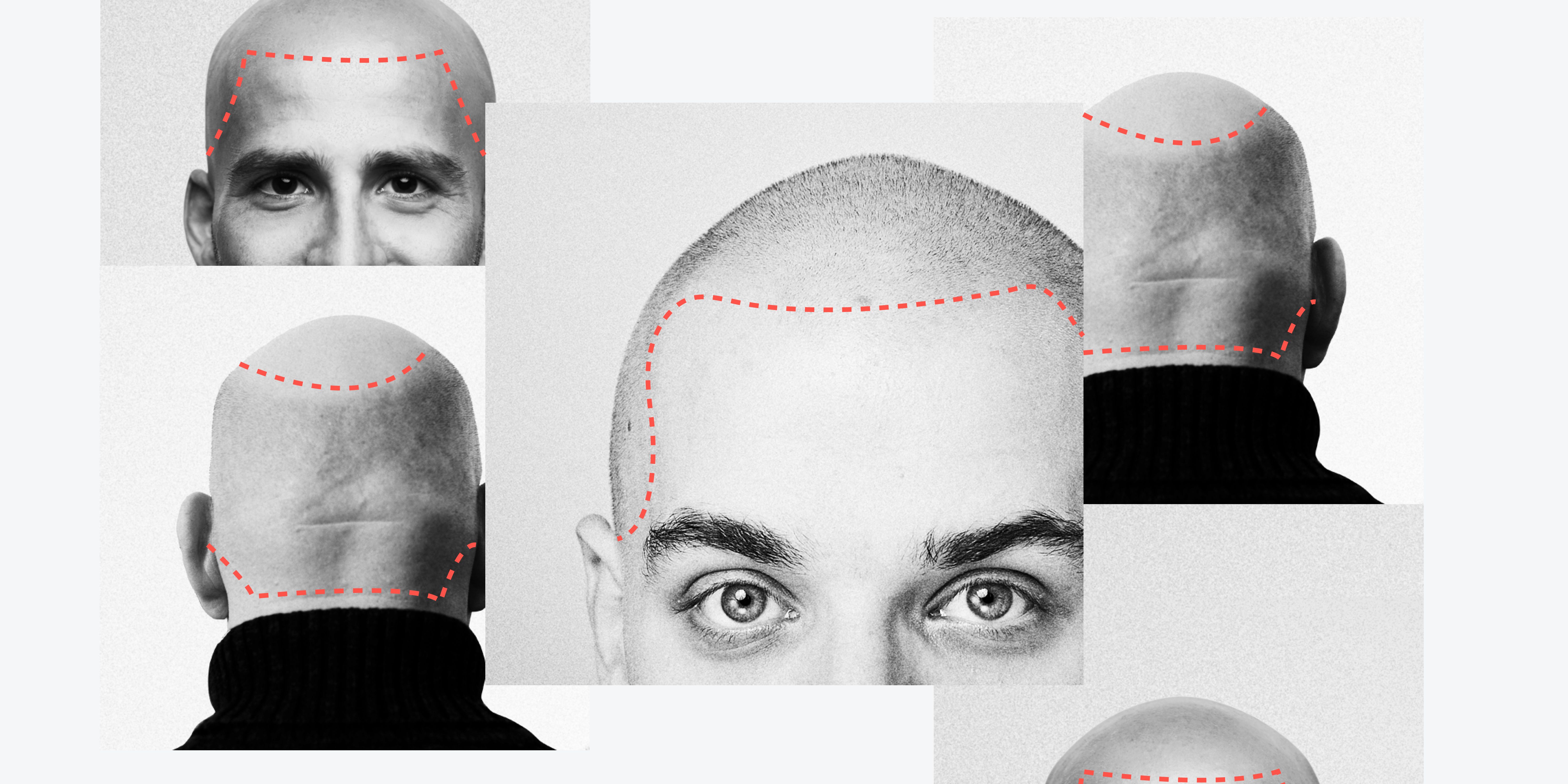 Hairline Tattoos Are A Thing, Here's What You Need To Know