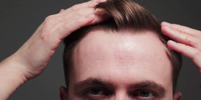 This Guy Just Shared 5 Tips for Hiding a Receding Hairline