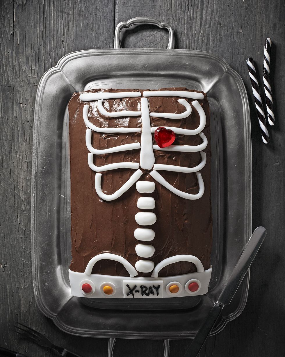 x ray cake