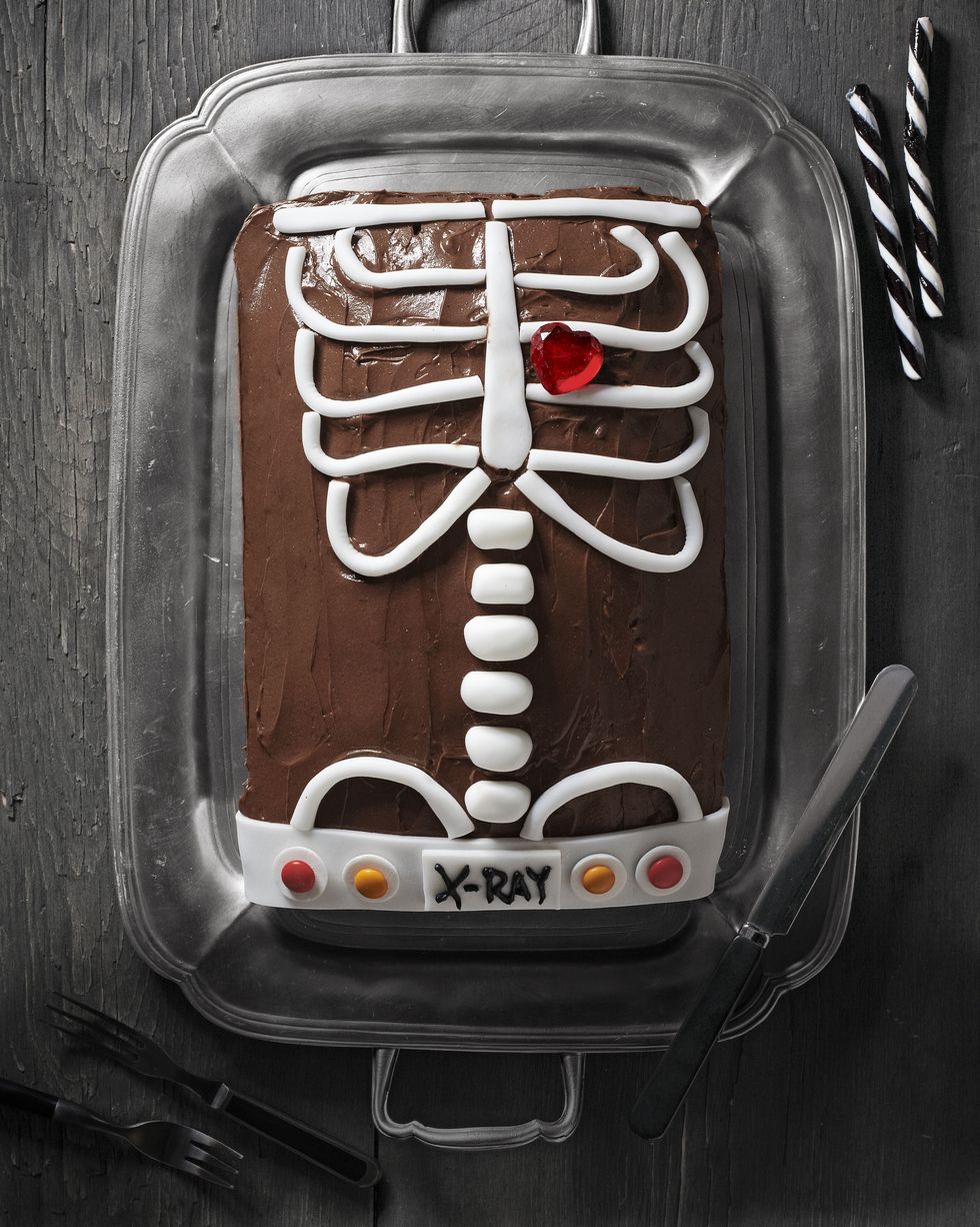 x ray cake