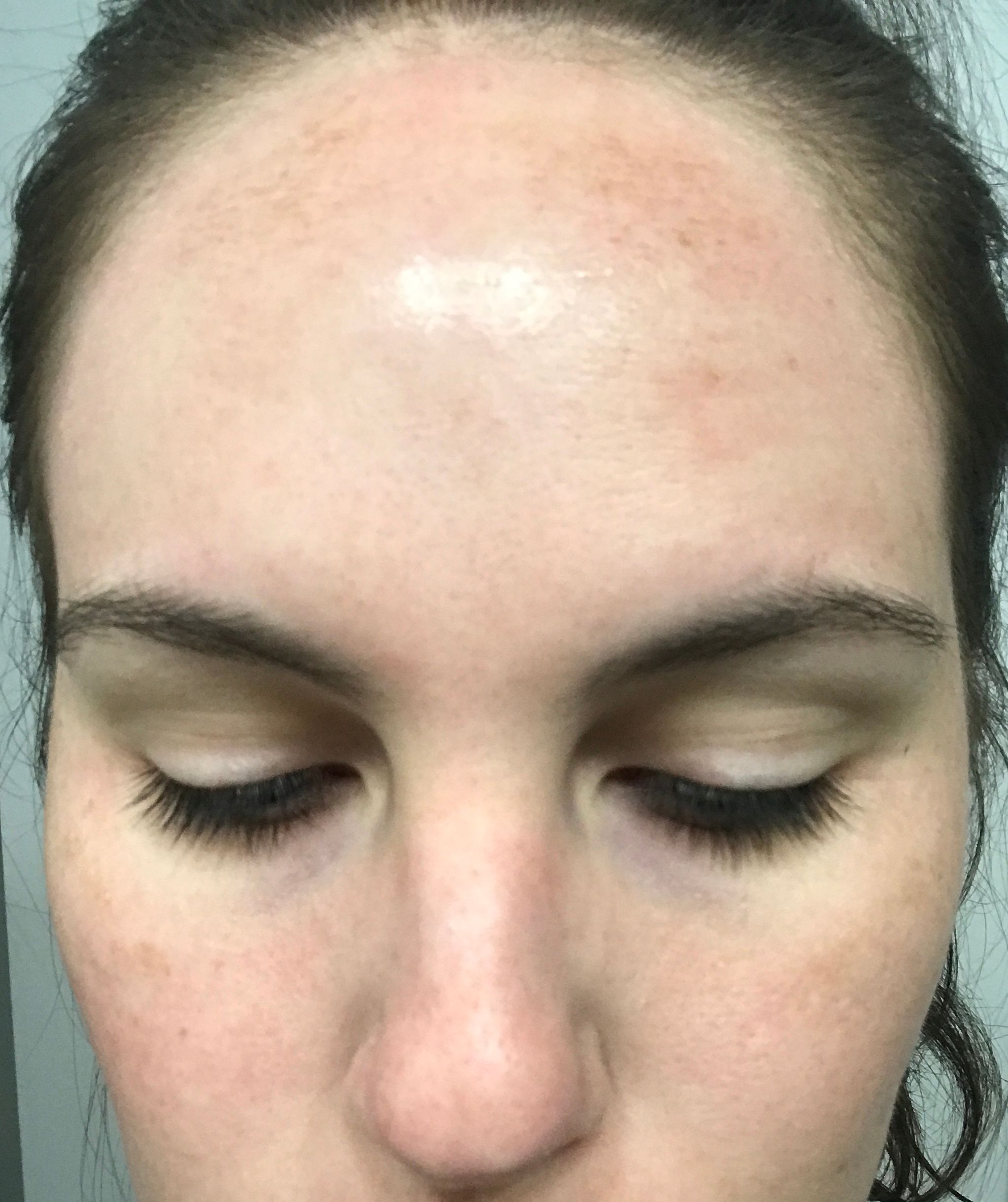 Reviewed the Hanacure Face Mask With and After Pics in