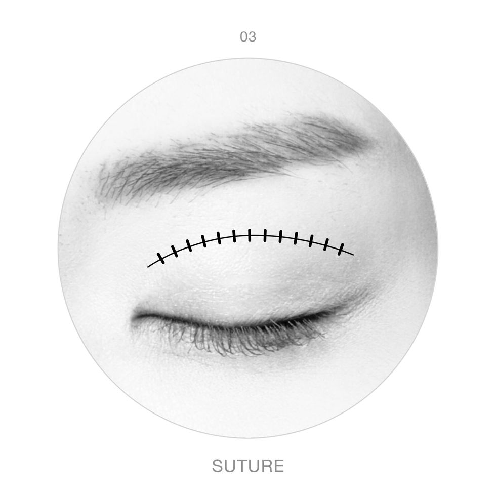 Don't use double eyelid tape - The Korea Times