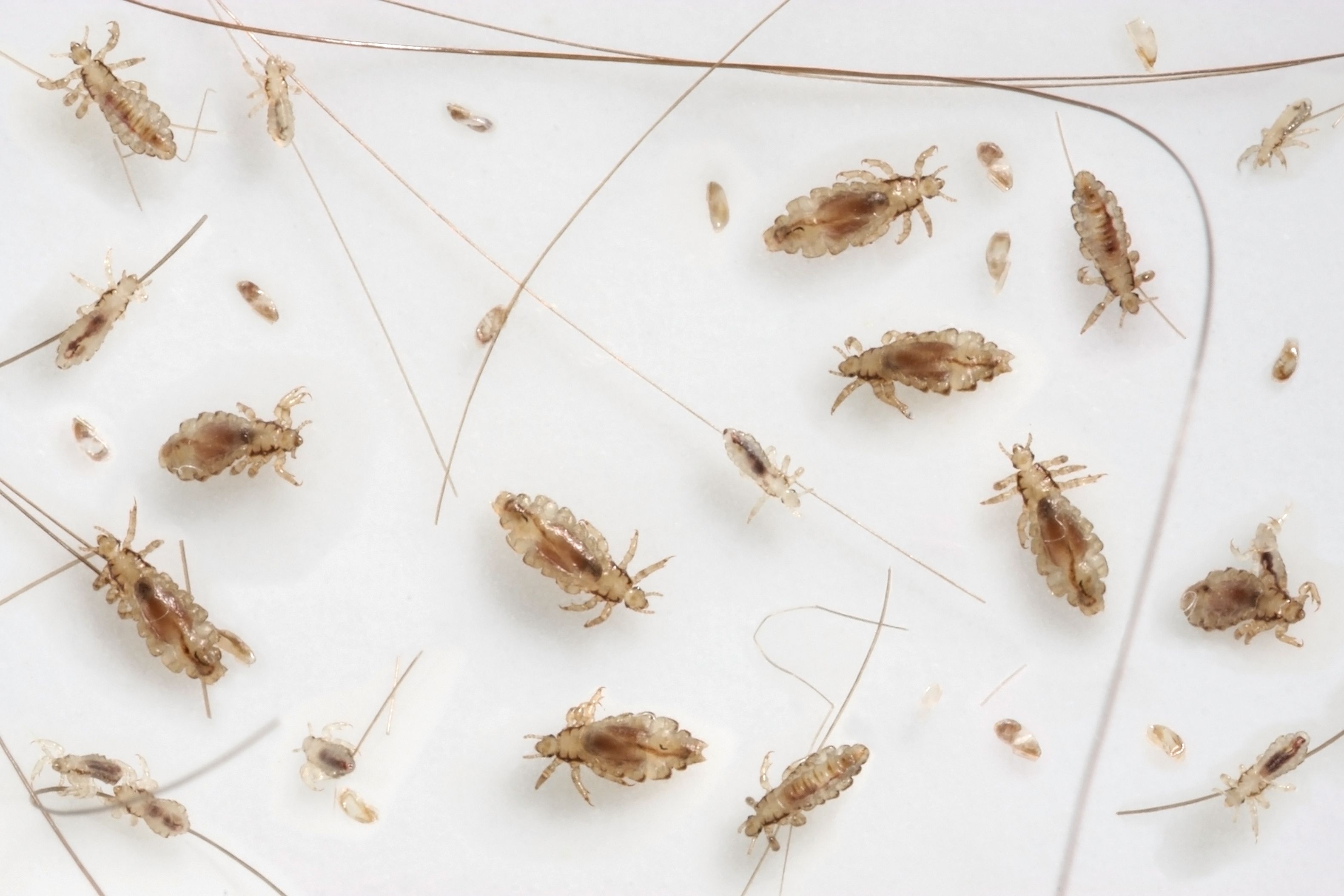 Lice  Symptoms and causes  Mayo Clinic
