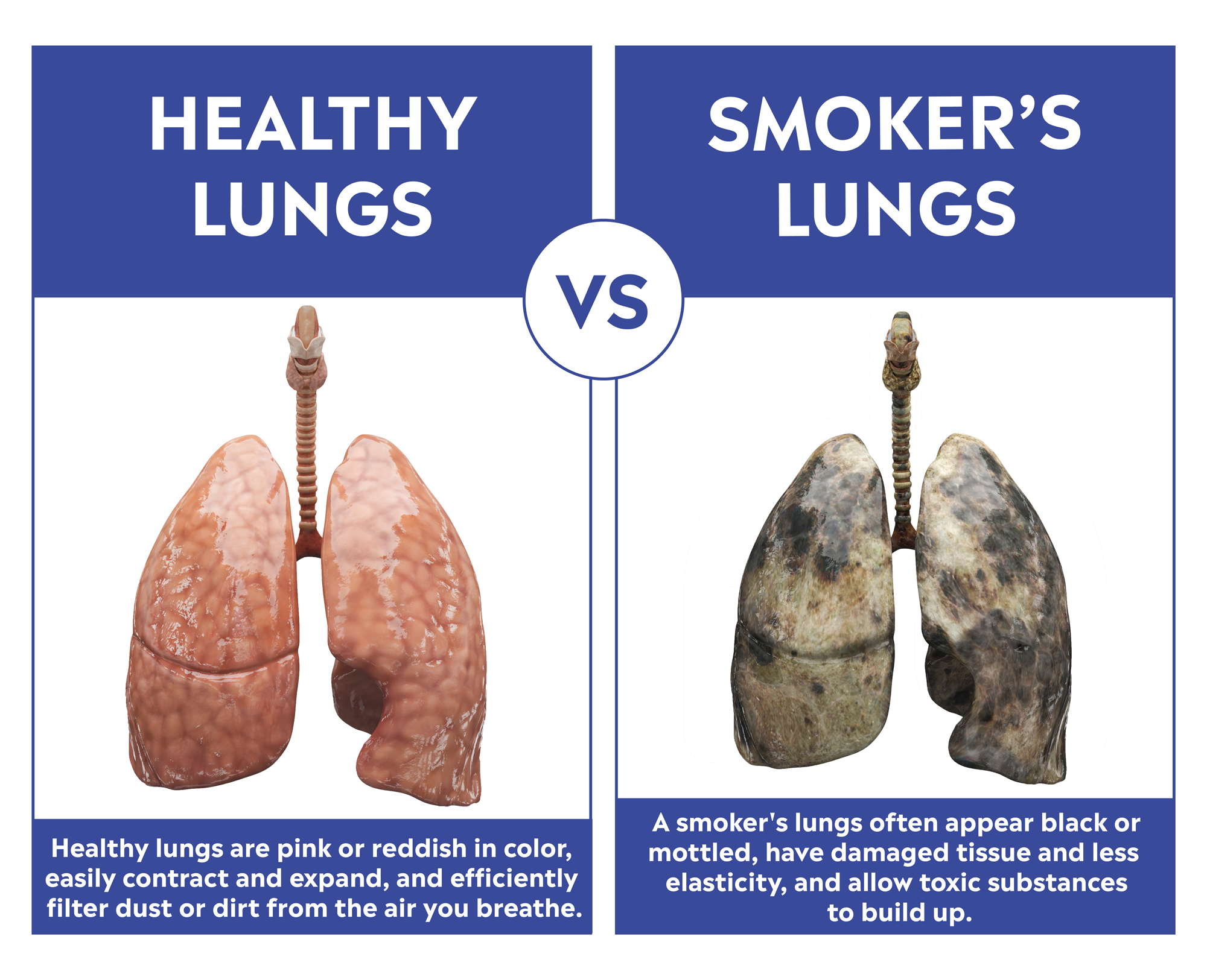 Pot Smokers Lungs Vs Healthy Lungs