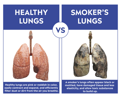 healthy-vs-smokers-lungs-1543616985.png?