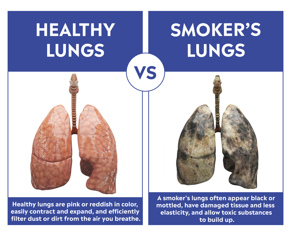 healthy vs smokers lungs