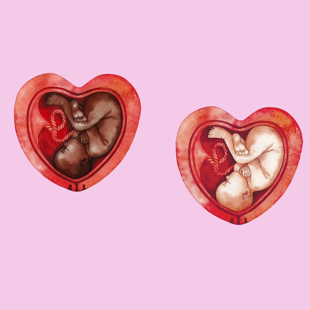 Heart-Shaped Uterus - What It Means And How To Tell If You Have One