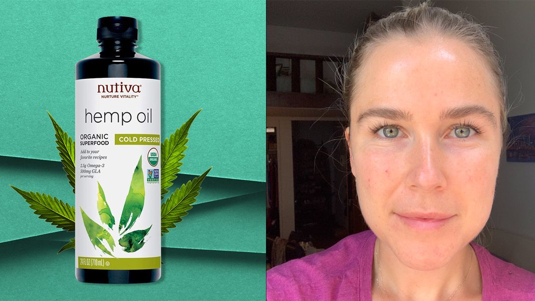 Hemp Seed Oil Benefits for Skin - Hemp Seed Oil for Acne