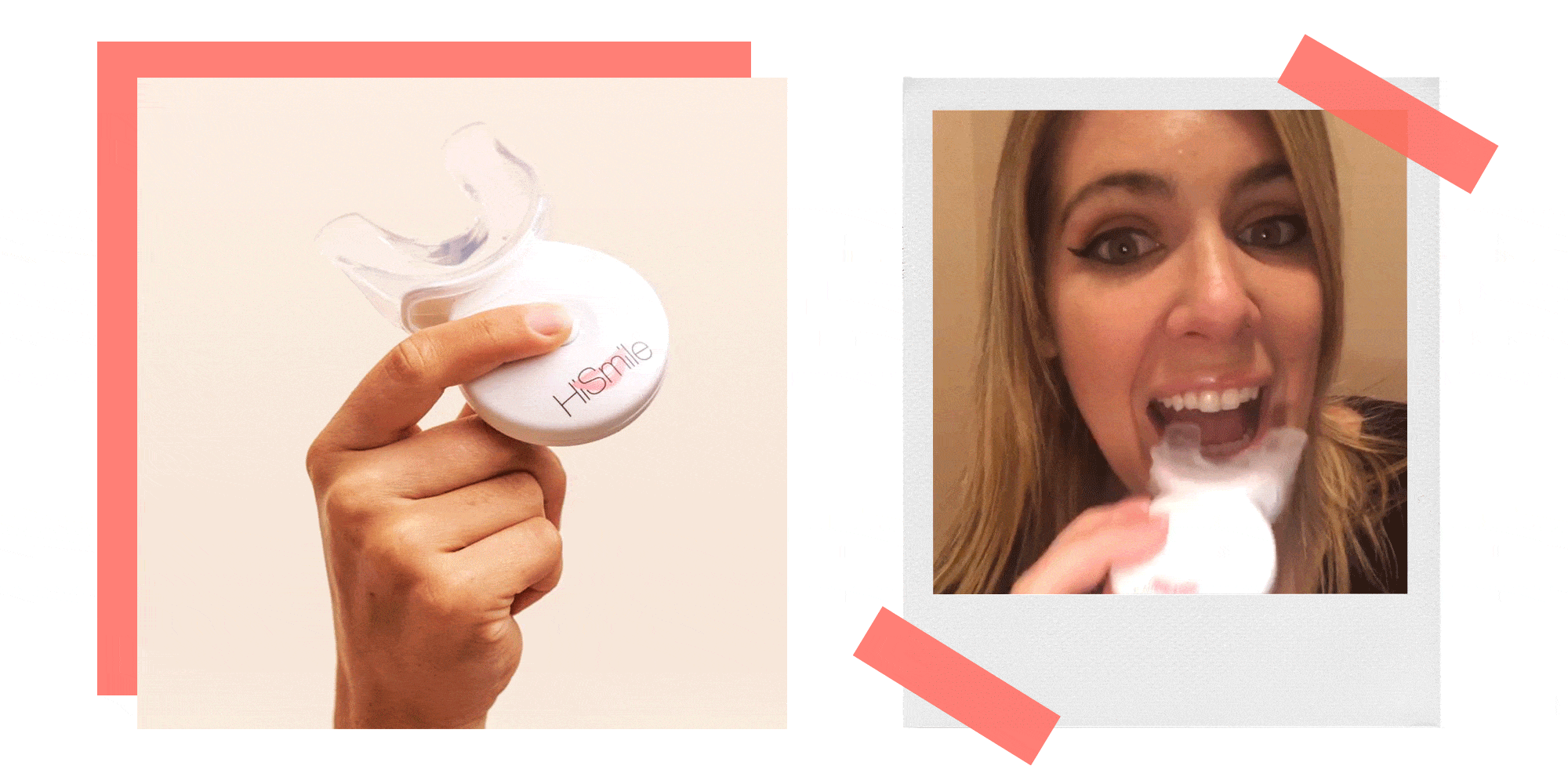 Does HiSmile Really Work? I Tried the Teeth Whitening Kit for Myself