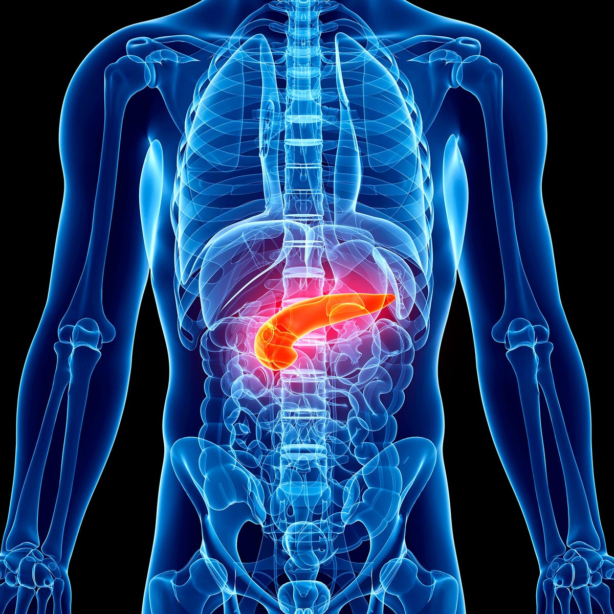 Pancreas Problems - Diabetes, Pancreatitis - Causes, Treatments