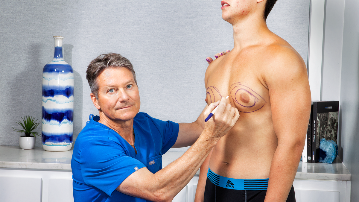 Dr. Robert Caridi Treats Man Boobs Shame With Gynecomastia Surgery