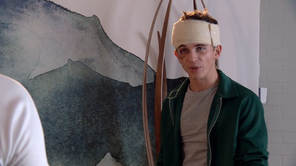 hollyoaks, lucas hay indoors wearing a grey t shirt with a green unzipped hoodie. he has bruises under his eyes and a large bandage around his forehead.