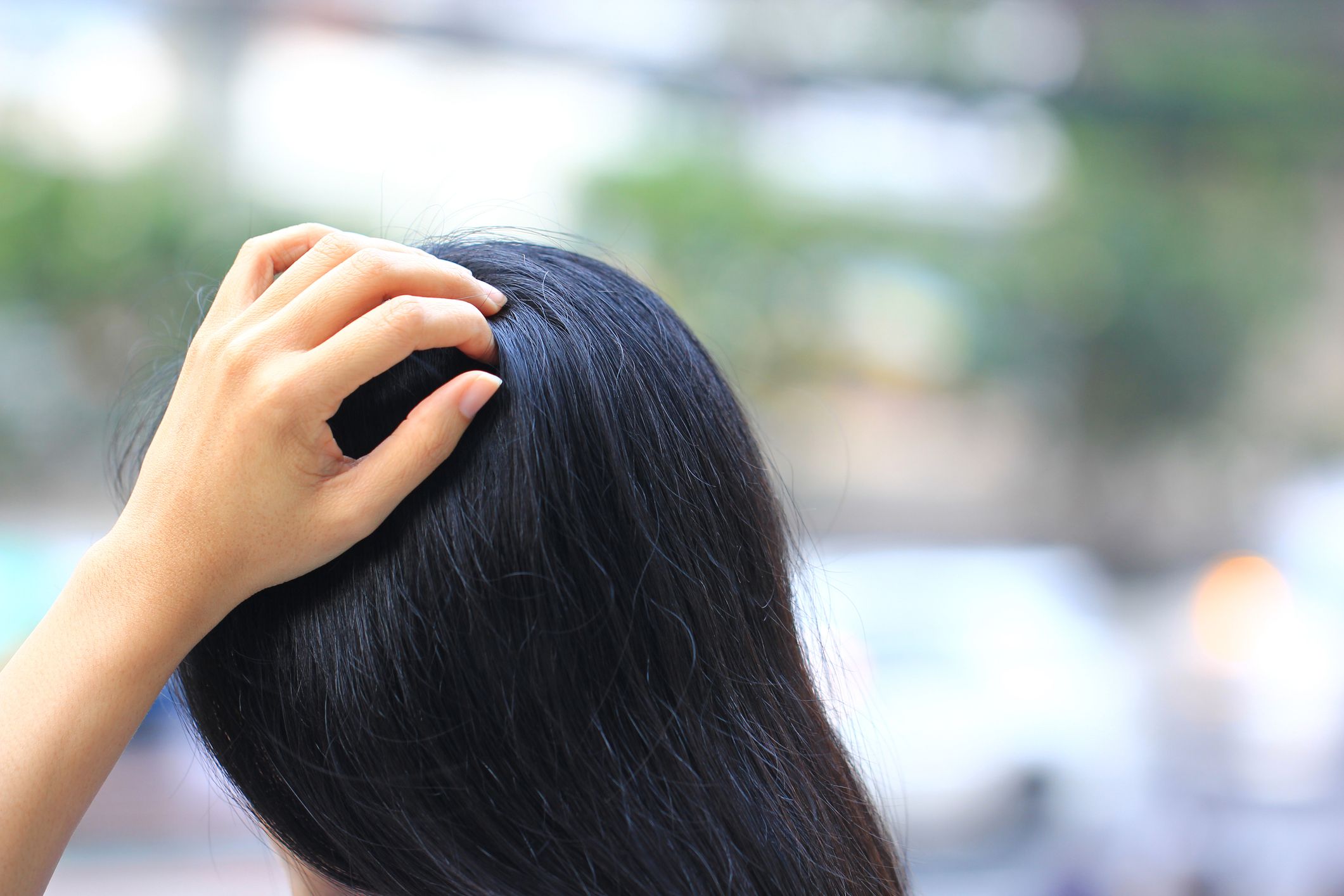 How To Treat Eczema Hair Loss  eczema seborrheic dermatitis and more   The Eczema Company Blog blog