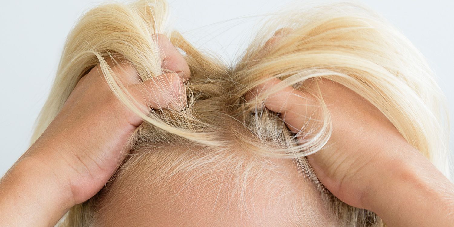 head lice eggs on blonde hair