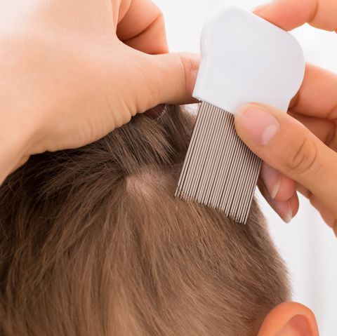 how to get rid of lice 