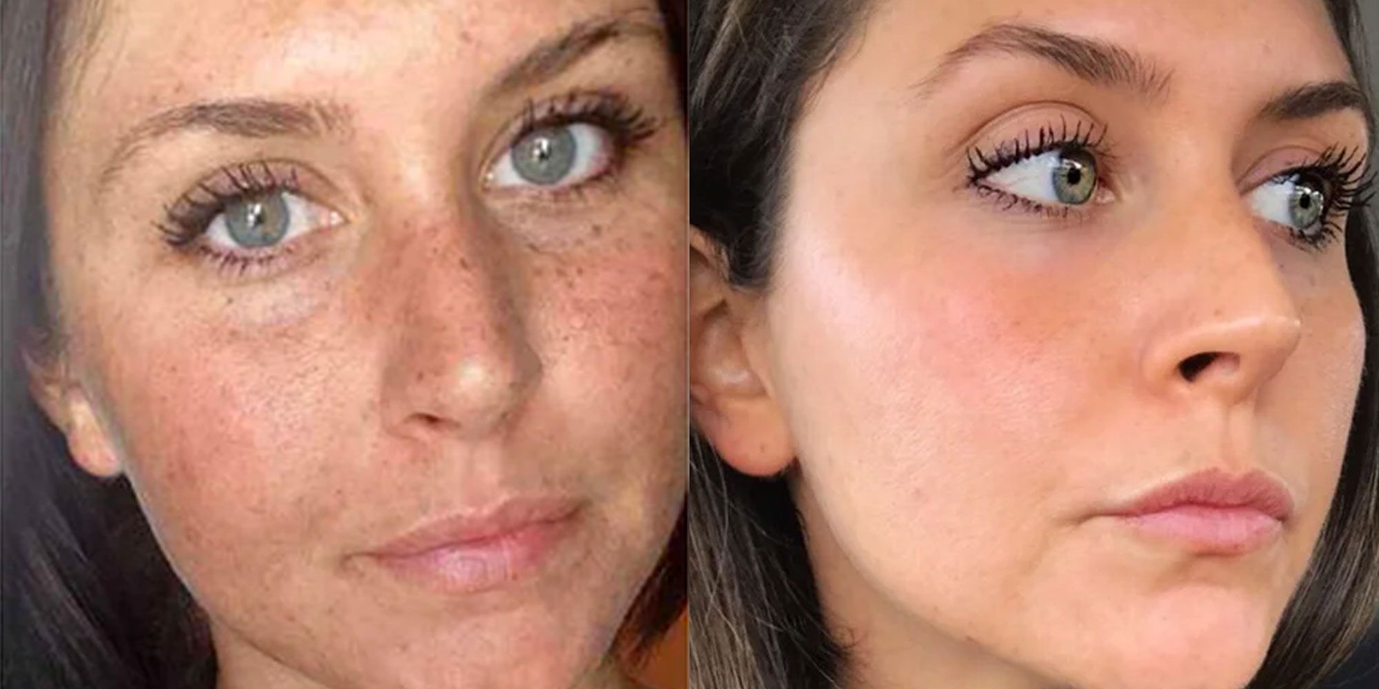 nægte Begge vokal This Woman's Reddit Before-And-After Sun Damage Photo Is Going Viral