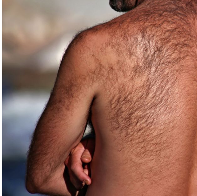 how to get rid of back hair