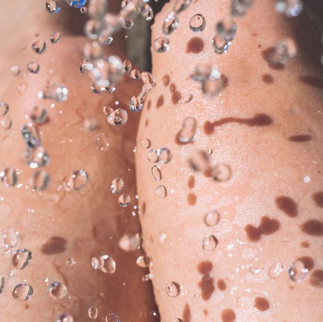 a close up of a person's skin
