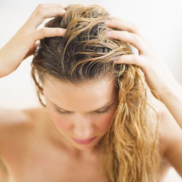 how to treat a sun burned scalp