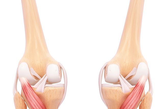 el músculo poplíteo es un músculo corto, aplanado y triangular situado en la parte de atrás de la rodilla