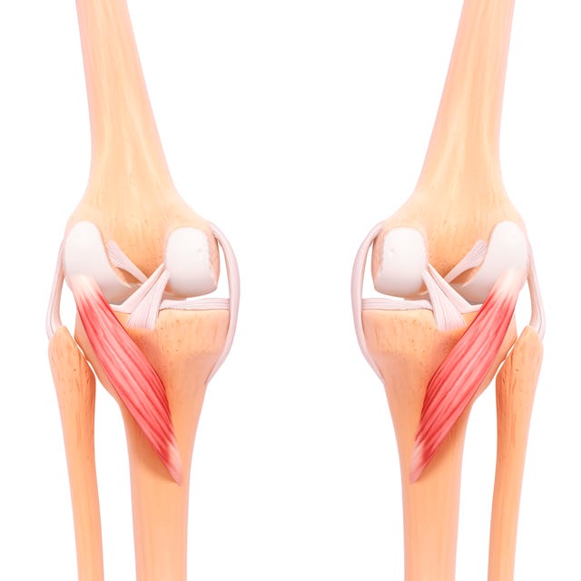 el músculo poplíteo es un músculo corto, aplanado y triangular situado en la parte de atrás de la rodilla