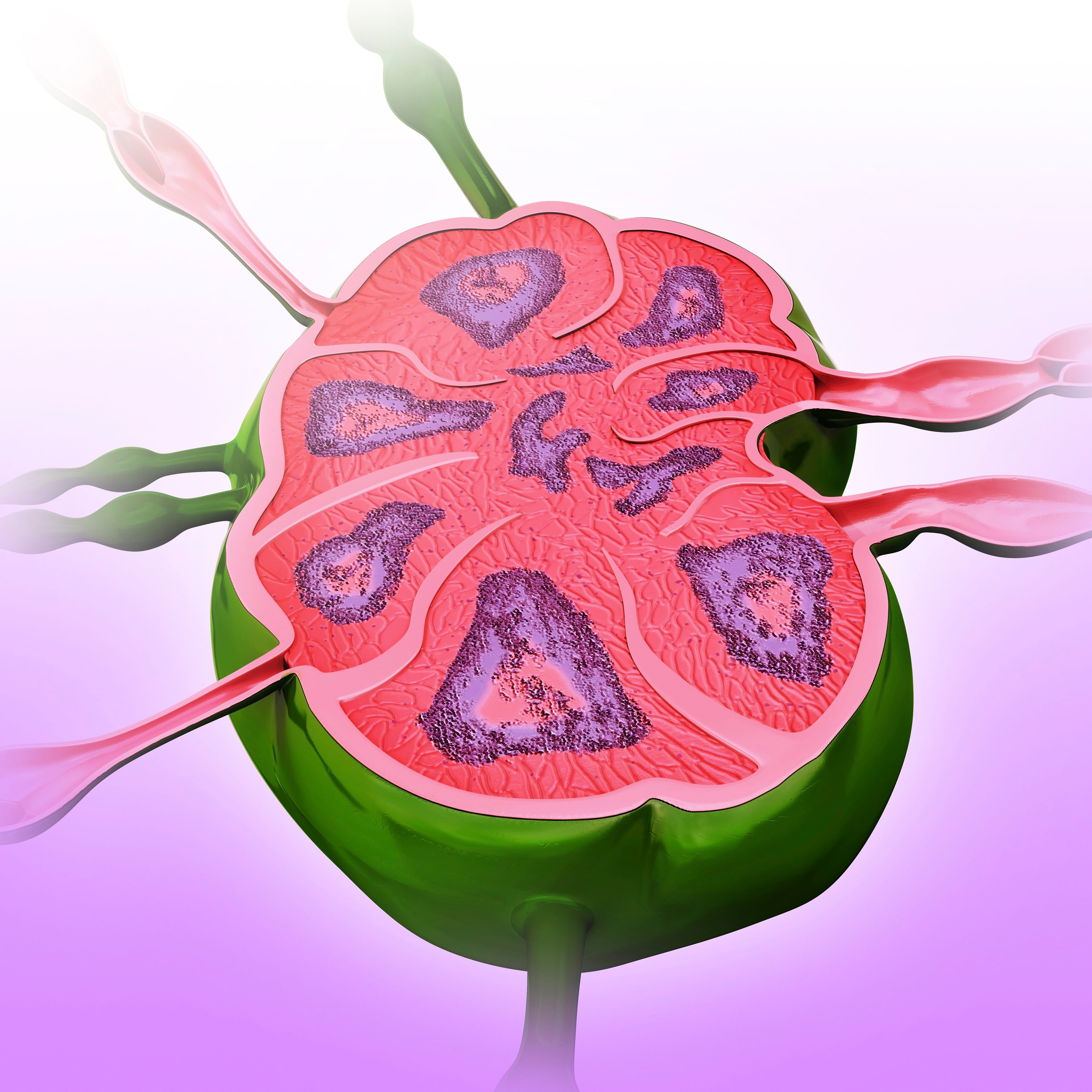 What Autoimmune Disease Causes Rash And Swollen Lymph Nodes 