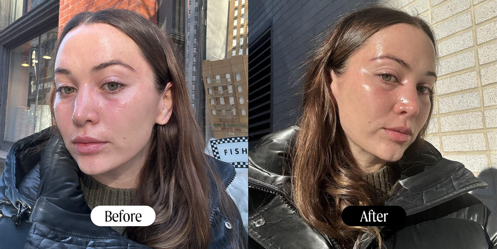 hydrafacial review