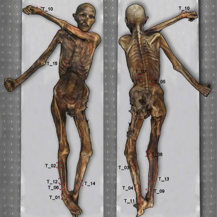 locations of otzi the iceman's tattoos on his body