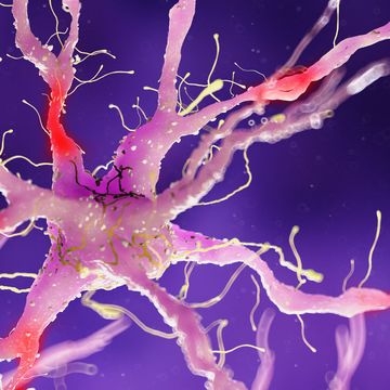 illustration of a damaged nerve cell