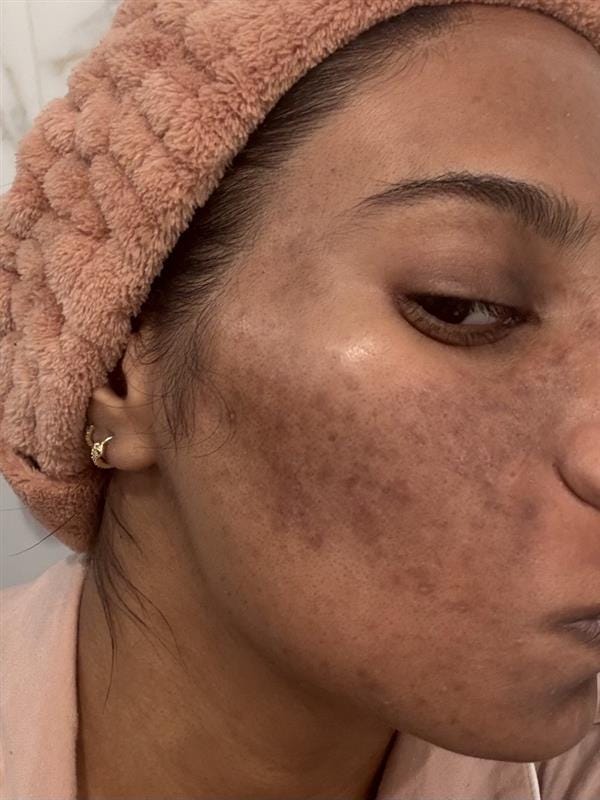 medicube skincare results