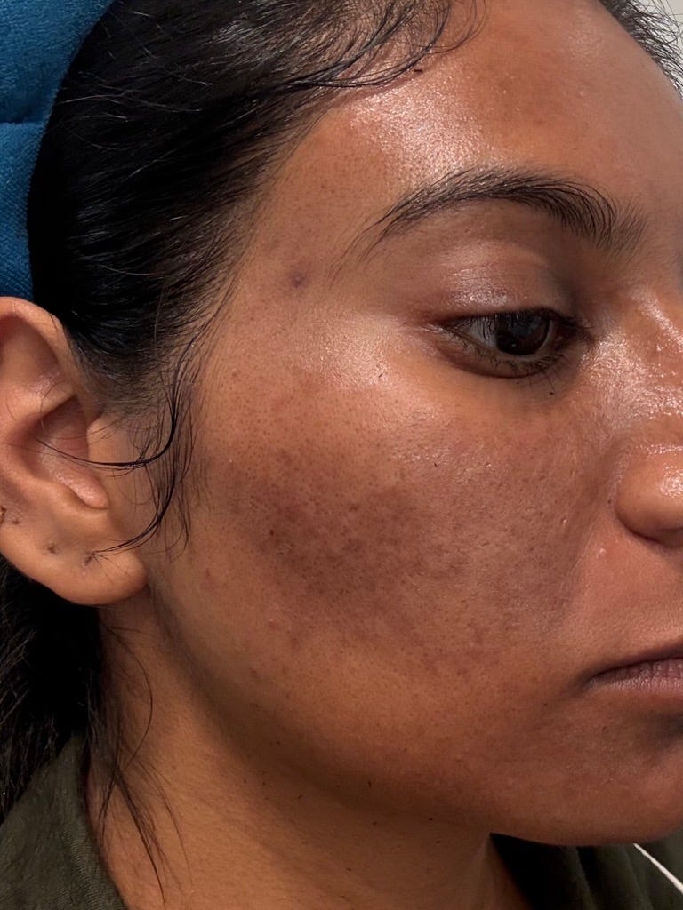 medicube skincare results