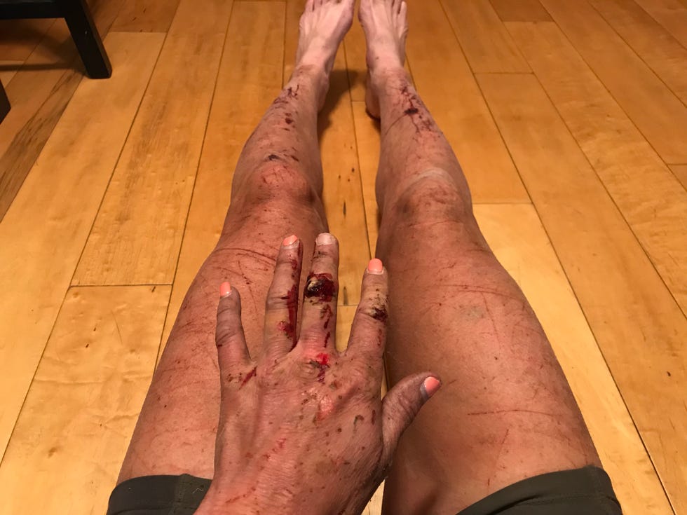 Flesh, Joint, Leg, Skin, Hand, Human body, Toe, Human leg, Vein, 