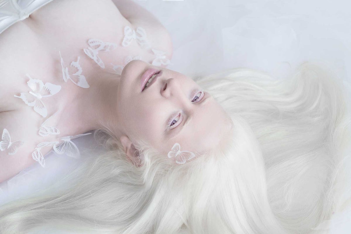 These 11 Photos of People With Albinism Against White Backgrounds Are So  Stunning