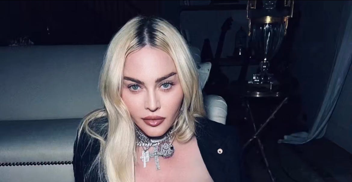 Madonna, 63, Has Sculpted Legs In Thigh-High Boots In TikTok Video