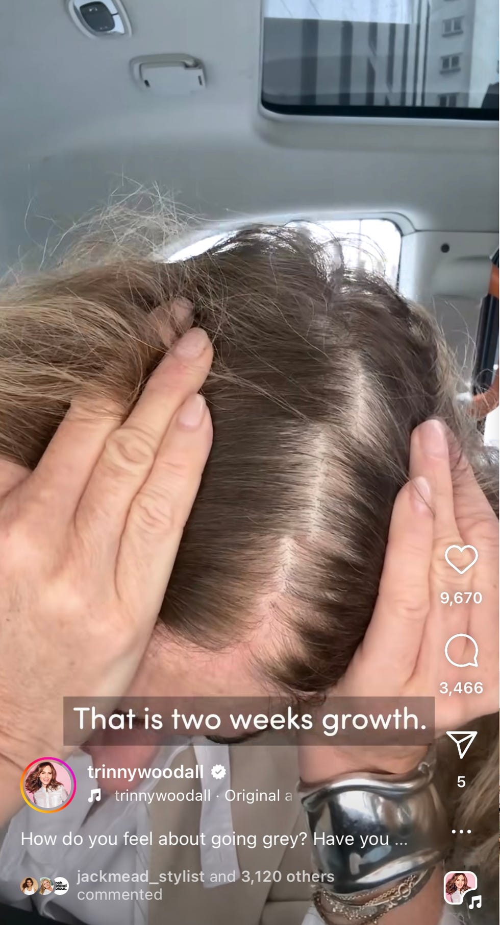trinny woodall going grey