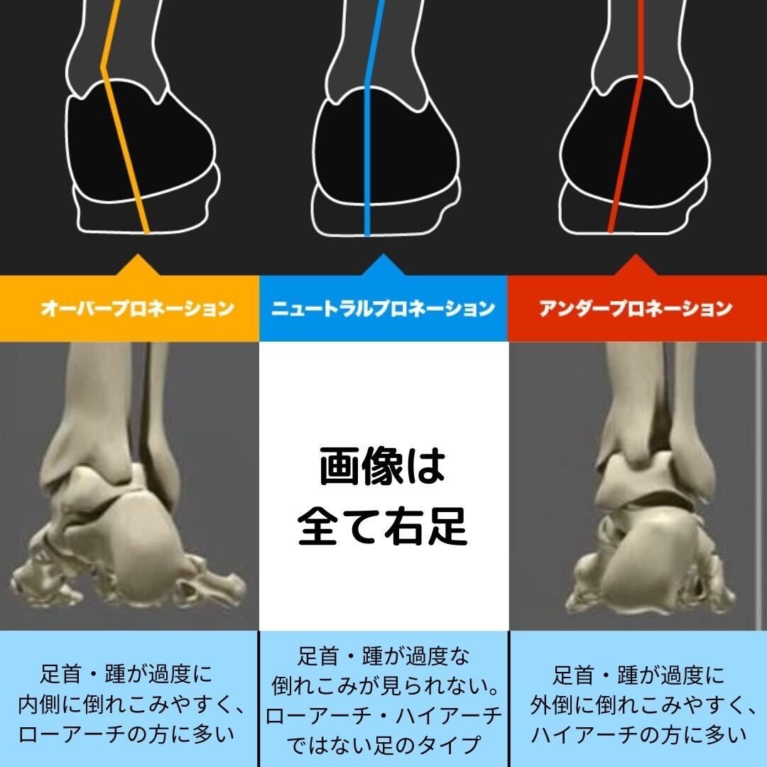 外反母趾 オーバープロネーション 踵ホールドブーツ