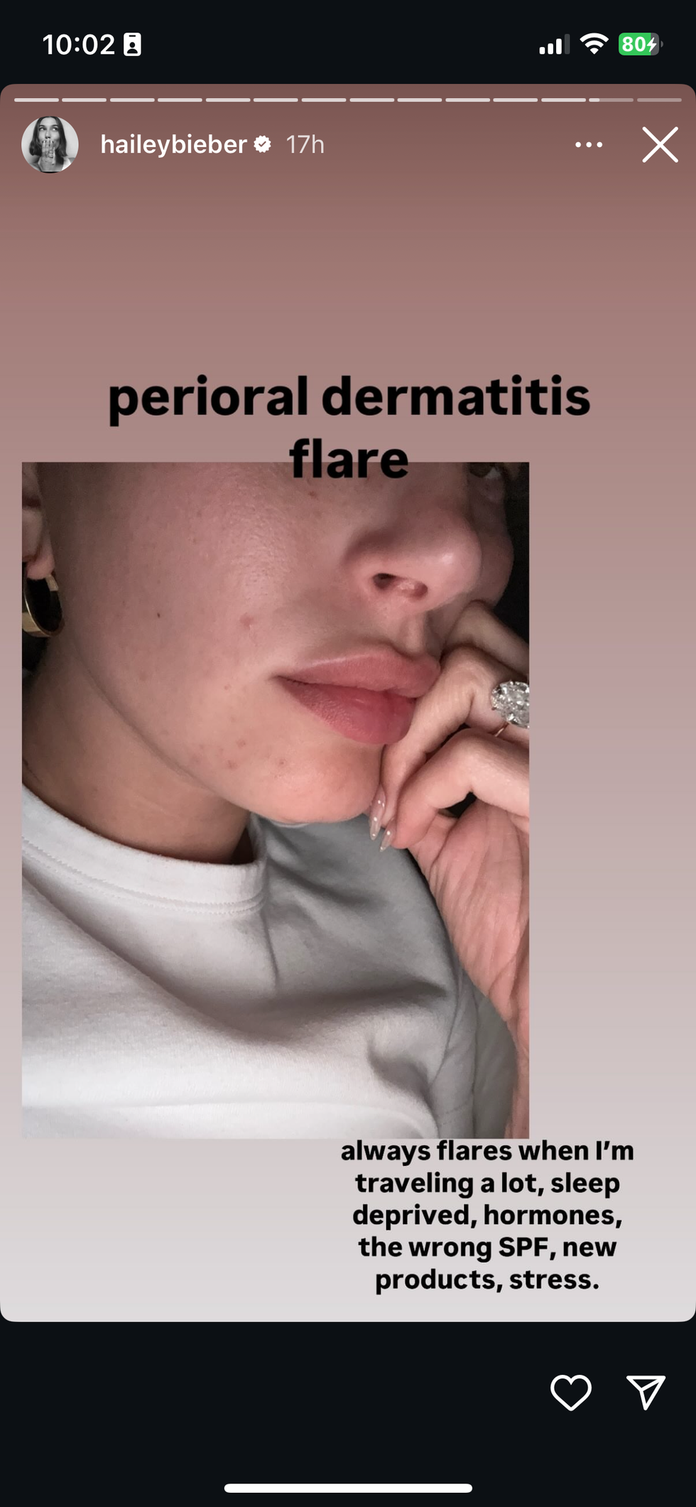 Hailey Bieber