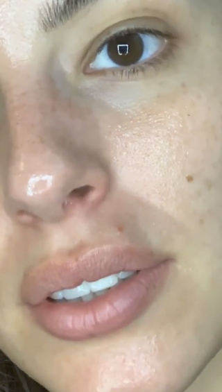 Ashley Graham No-Makeup Acne Instagram Selfie