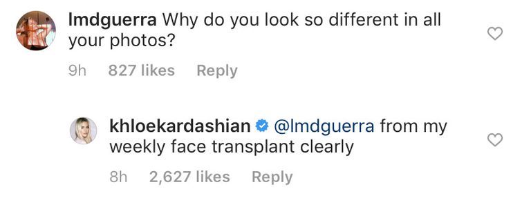khloe kardashian new face