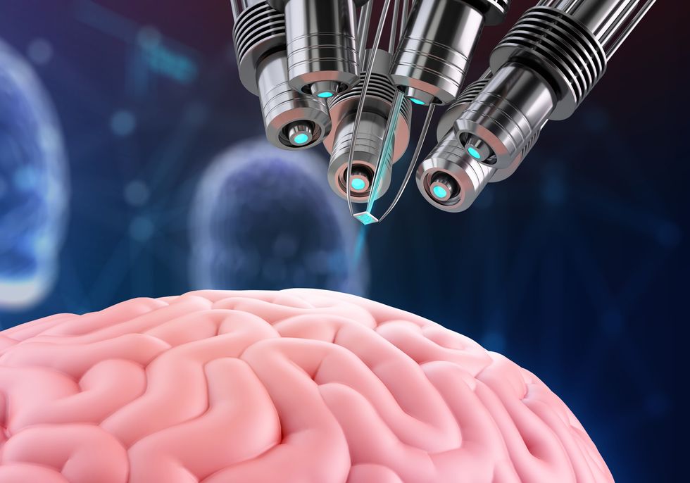 implanting chip in human brain, illustration
